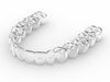 Clear Retainers