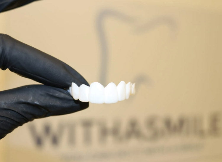 Full Set Of Withasmile Veneers 06 With A Smile Veneers