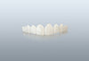 Replacement - Single Arch Veneer (For existing customers)