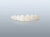 Single Arch Veneers 03 With A Smile Veneers