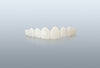 Replacement - Full Set of Veneers (For existing customers)