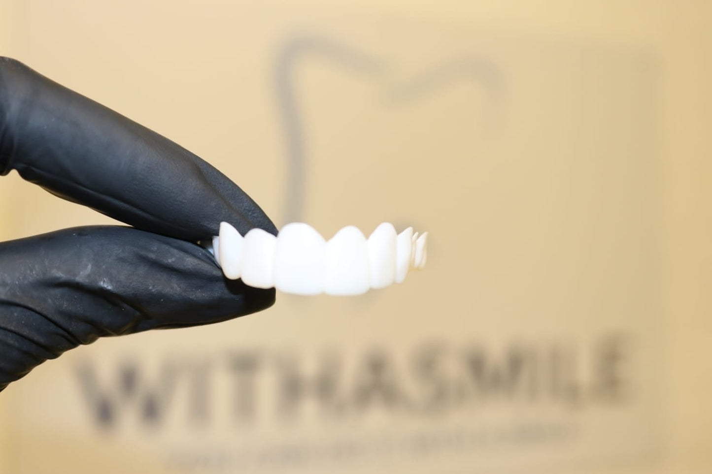 Ultra Thin Single Arch Veneer